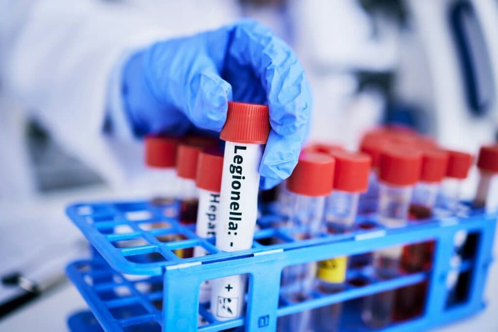 Scientist examining bacteria sample in laboratory — healthcare consulting and exposure science