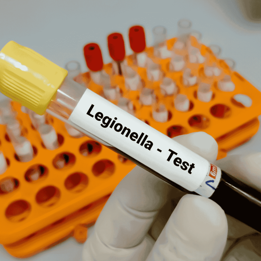 Legionella in drinking water systems assessment